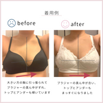 画像をギャラリービューアに読み込む, 《特許取得》乳房の左右差を整える  エメリタ